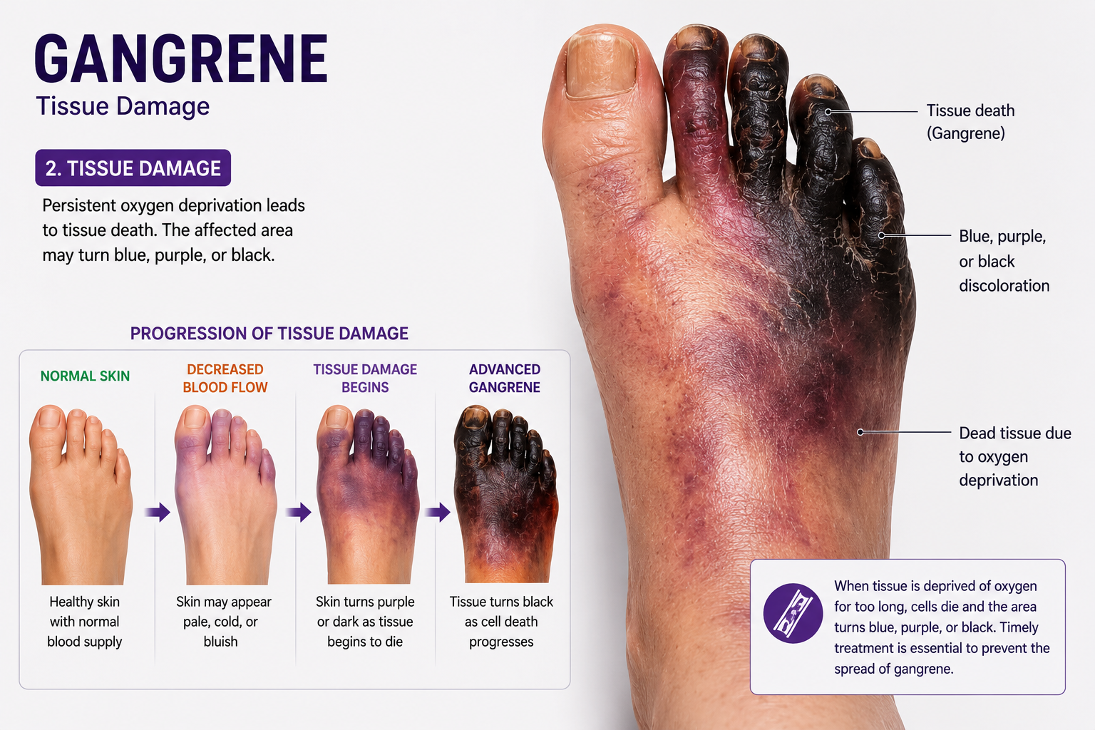 Tissue damage